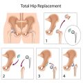 Wissenschaftliche Grundlagen der Krankengymnastik: Biomechanik und Physiologie