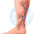 Klinische Assessments zur Identifikation von Sturzrisikofaktoren bei Senioren