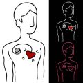 Wearables als Unterstützungstools in der Nachsorge: Erfahrungen deutscher Patient:innen und Therapeut:innen