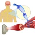 Medikamentöse Therapie in der Reha: Einstellung, Überwachung und patientengerechte Information