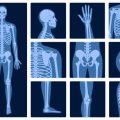 Die Rolle des Hausarztes beim Reha-Antrag und seine Bedeutung im Prozess